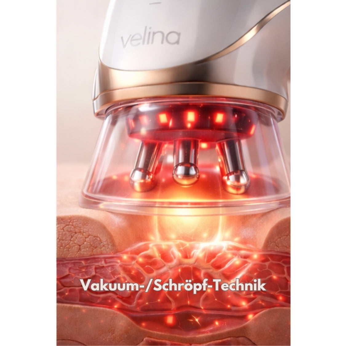 Vakuum Therapie – Gewebeaktivierung